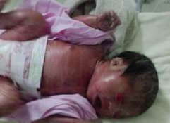 胎停、流产，可能是男性精子DNA碎片出了问题